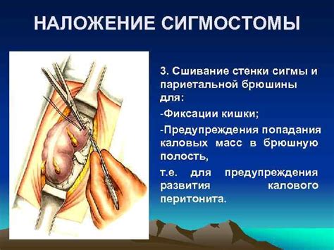 Нежелательное проведение операции при ОРВИ