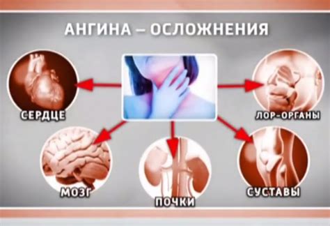 Неприятные последствия болезни и возможные осложнения