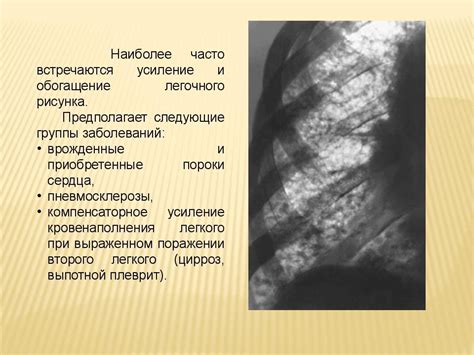 Обогащен составом