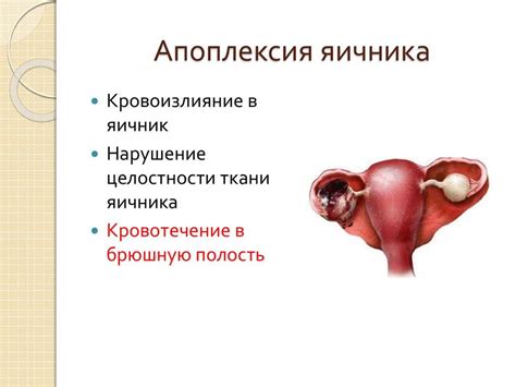 Ограничения и рекомендации для занятий спортом после апоплексии яичника