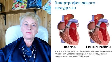 Опасность для сердца: повышение давления и риск инфаркта