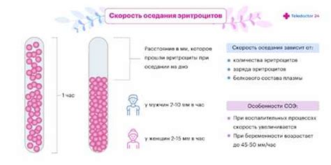 Операции при повышенной соэ