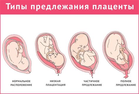 Определение гистологии плаценты: методы и особенности