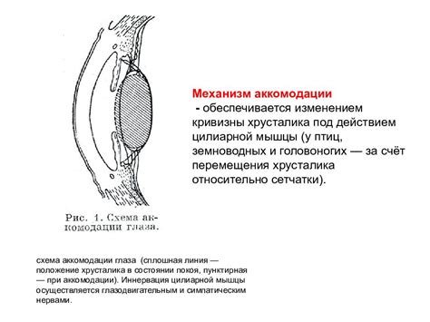 Оптическая коррекция кривизны глаза у грудничка