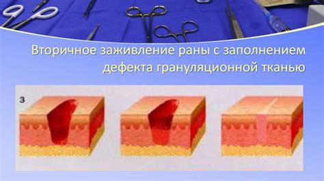 Осмотр и оценка заживления раны
