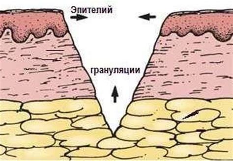 Особенности заживления раны на пляже