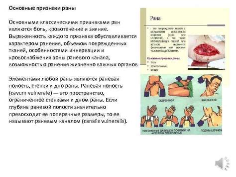 Остановите кровотечение и снимите боль