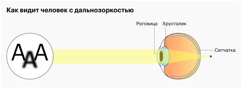 Очки и их влияние на слух у людей с дальнозоркостью