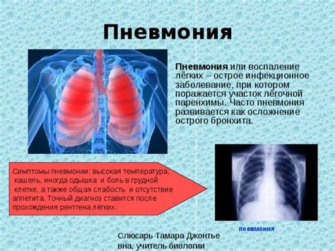 Пневмония: душ и заболевание