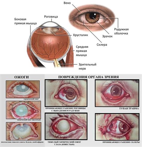 Повреждение глаза и способы его лечения