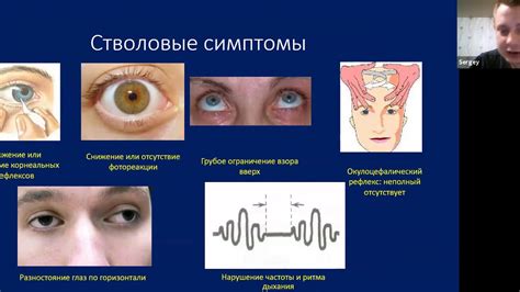 Повреждение мозга, желтуха, другие осложнения