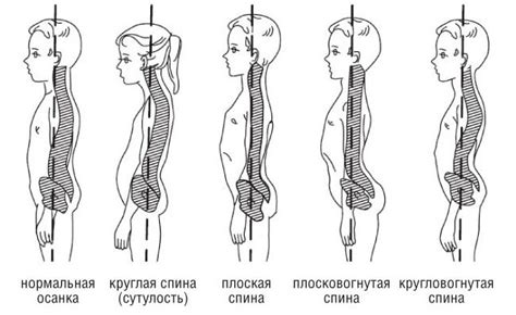 Постава тела