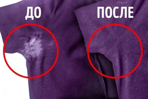 Почему сахар оставляет следы на одежде