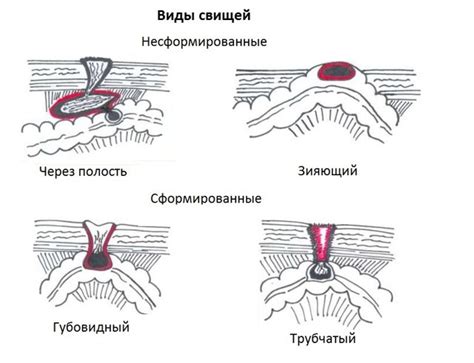 Почему швы появляются в блендере