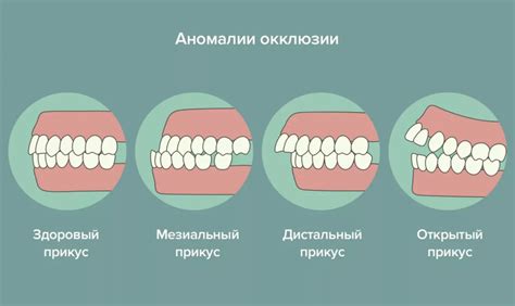 Правильное позиционирование челюстей и губ для четкой дикции