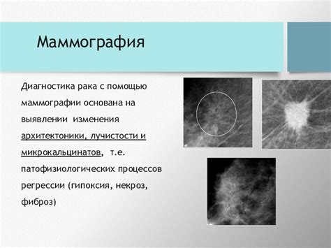 Преимущества и возможности сочетания двух методов диагностики: маммографии и КТ