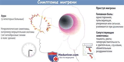 Прецеденты: случаи мигрени и наказание в МВД