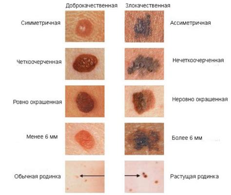 Признаки травмированной кожи