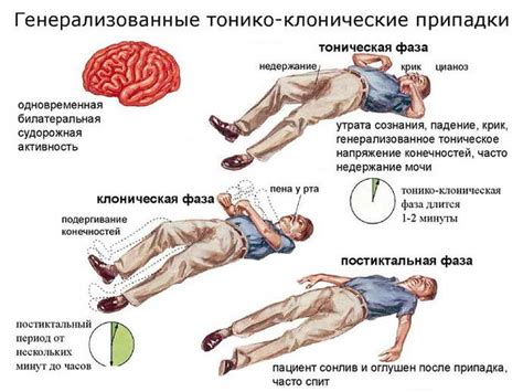 Применение хирургического лечения эпилепсии