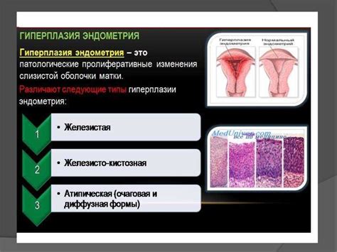 Причины возникновения гиперплазии эндометрия