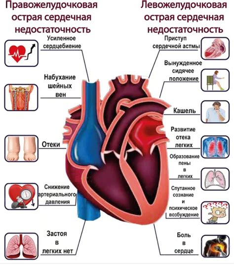 Причины и симптомы сердечной недостаточности