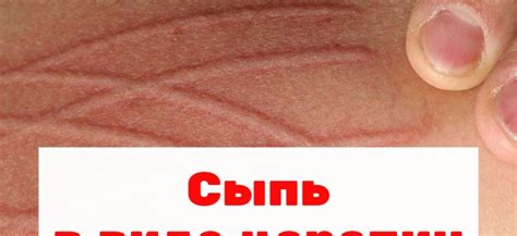 Причины царапин