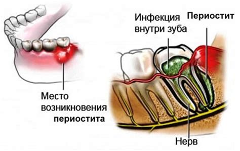 Прогревание флюса на щеке: основные рекомендации