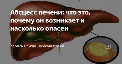 Промывание печени после молока - насколько это необходимо?