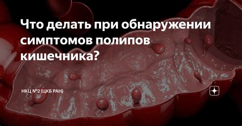 Пропадет ли полип самостоятельно?