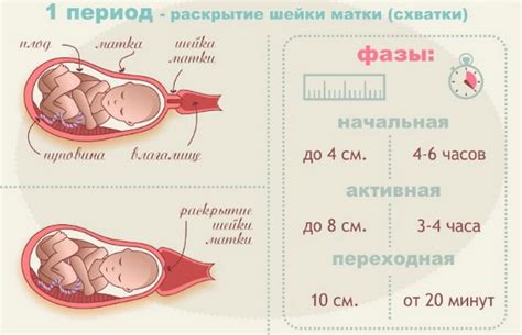 Профилактические меры и рекомендации перед родами