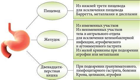 Раздражение слизистой оболочки желудка