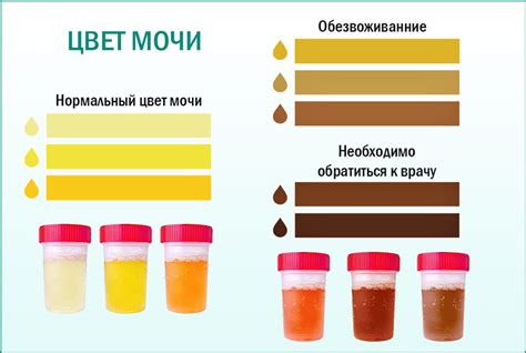 Различия в составе мочи