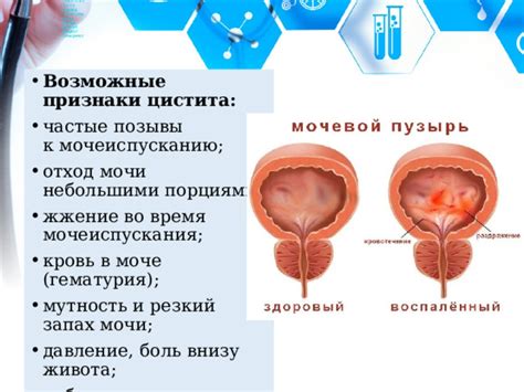 Различия в частоте мочеиспускания и объеме мочи