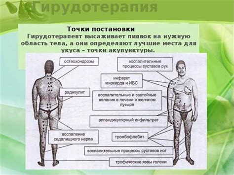 Рекомендации для применения пиявок на лимфоузлы: врачебный совет