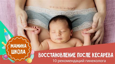 Рекомендации по взятию ребенка после кесарева