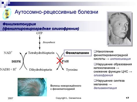 Роль наследственности и гормонального фона в изменении типа кожи головы