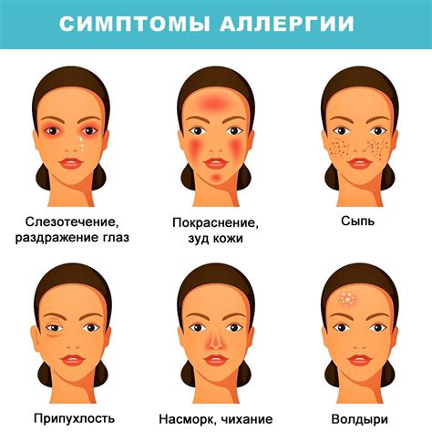 Симптомы аллергии на лице