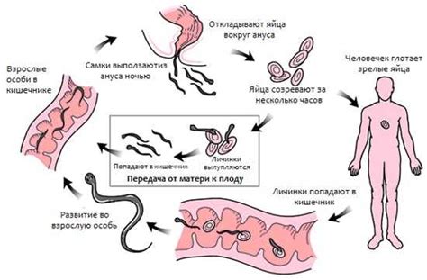 Симптомы гельминтоза: как распознать паразитарное поражение