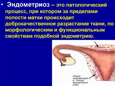 Симптомы и диагностика: как распознать проблемы с эндометрием