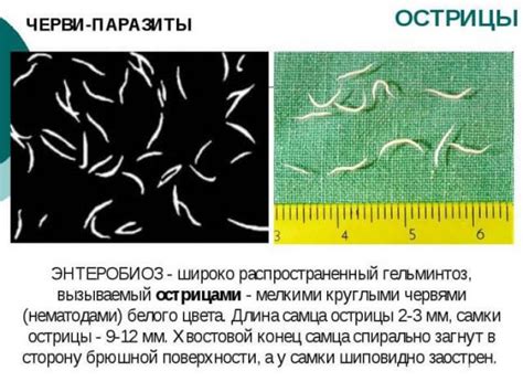 Симптомы и признаки наличия остриц