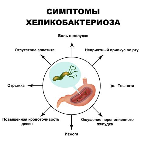 Симптомы хеликобактер пилори