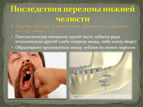 Симптомы хруста в челюсти