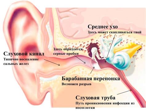 Советы и рекомендации по профилактике боли в ухе