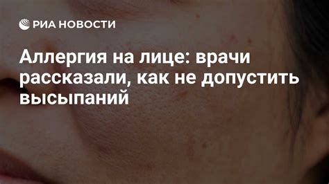 Советы по уходу за лицом при аллергии