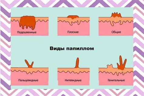 Удаление серой области