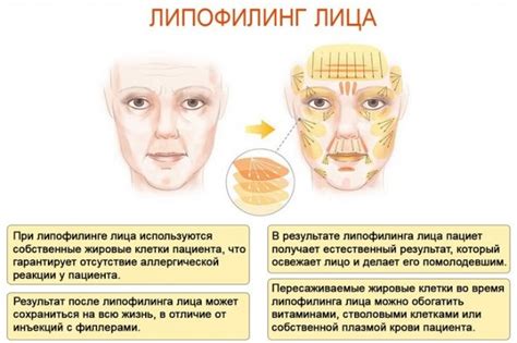 Упражнения для увеличения скул в домашних условиях