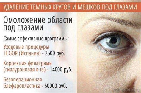 Устранение впадин под глазами: эффективные методы в домашних условиях