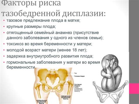 Факторы риска дисплазии после конизации