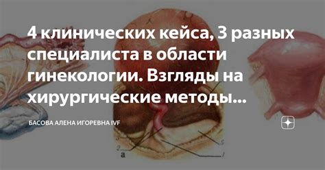 Хирургические методы лечения хуснуллина