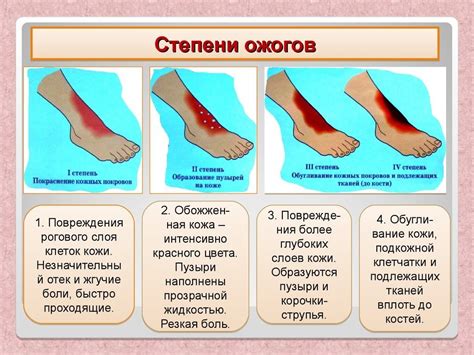 Что делать при ожоге губ во время прыжка с парашютом?